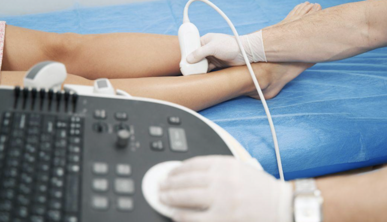 Arterial Doppler