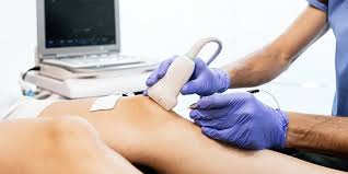 Venous Dopple r(DVT)