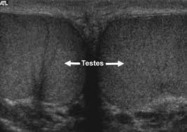 Testes Ultrasound