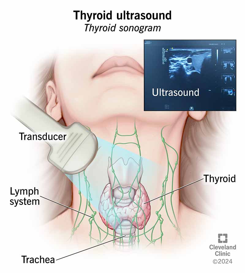 Thyroid Ultrasound