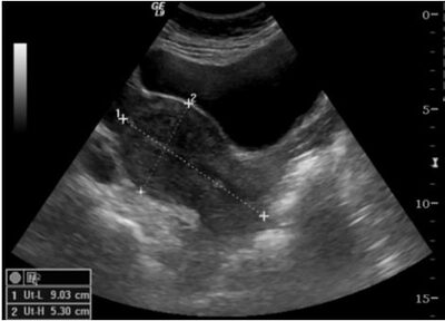 Sonographer performing a pelvic ultrasound at First Glimpse, Cape Town