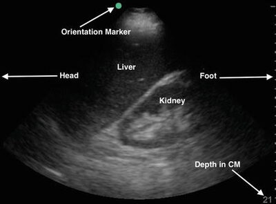 Abdominal Scan